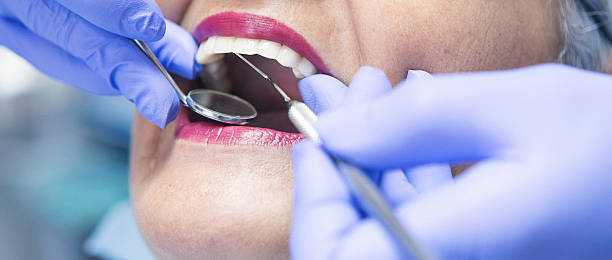 Best Emergency Treatment for Dental Infections or Abscesses in Fultonde, AL